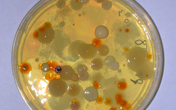 microbes in a substance in a petri dish